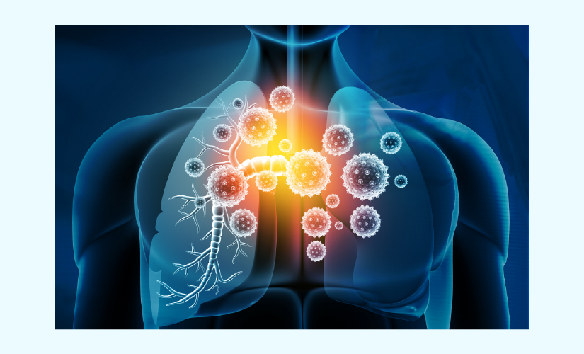 Apoptosis Implication In Viral Infection
